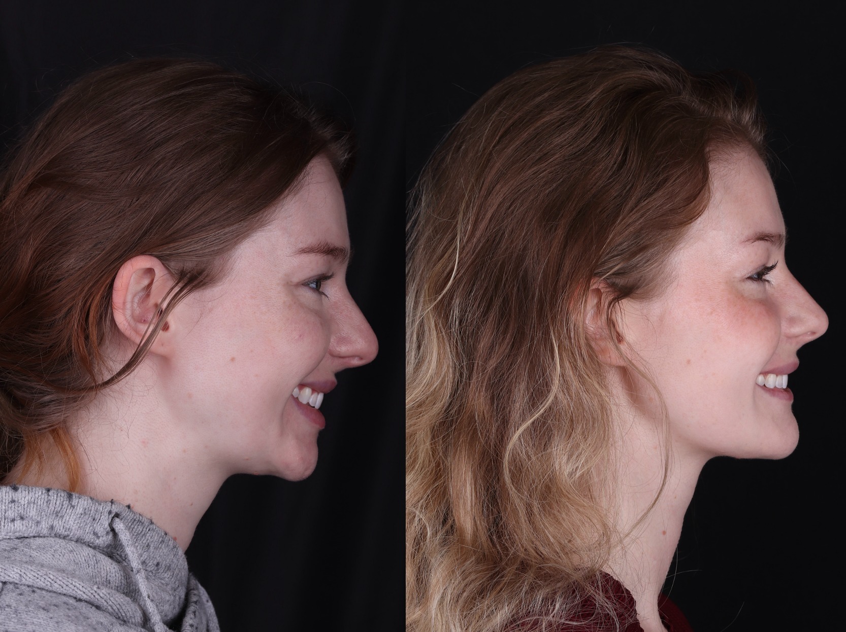 Side-by-side smiling profile photographs
